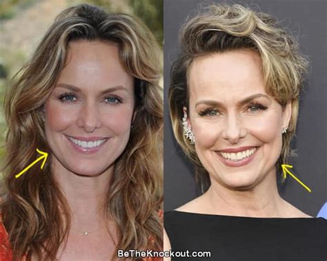 Melora Hardin Plastic Surgery Comparison Photos.